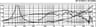 Monacor SP-310CX 10 inch 2 ohm loudspeaker driver thumbnail view 3