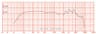 Oberton 10B200 10 inch 8 ohm loudspeaker driver thumbnail view 2