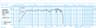 Oberton 18B450 18 inch 8 ohm loudspeaker driver thumbnail view 1
